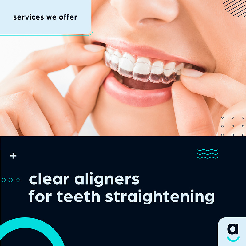 Transform Your Smile with Clear Aligners